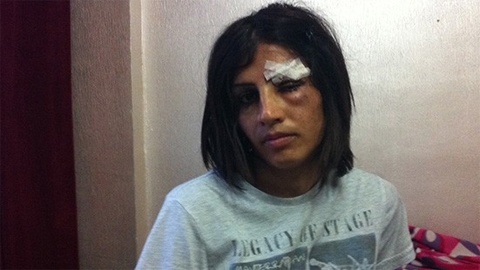 Haber | Seks işçisi trans kadın kaçırıldı mı?