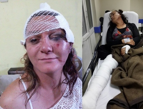 Haber | Mersin ve İstanbul’da transfobik saldırılar