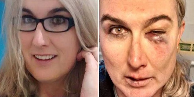 Haber | Trans müzisyen Stephanie McCarthy`e kendi konserinde saldırı!