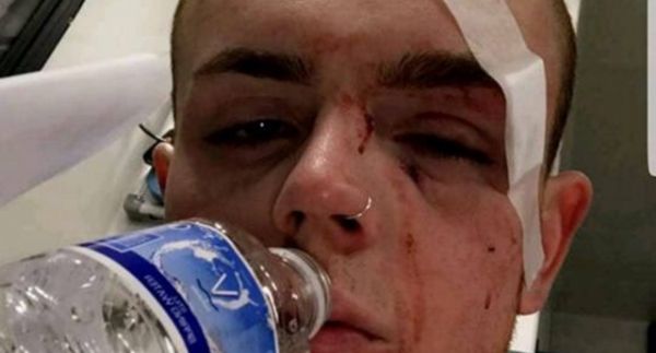 Haber | Homofobik Nefret Suçu Yine Bir Genci Mahvetti!