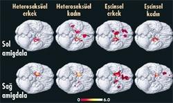 Haber | Gay erkeğin beyni ile kadınınki benzer
